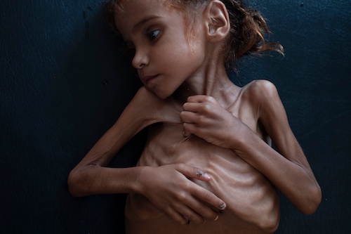Amal-Hussaun-Died-From-Starvation-Thanks-to-Sauds