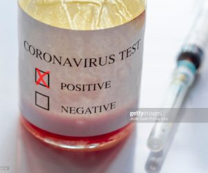 First Confirmed COVID-19 Death Reported In CARICOM Region coronavirus-positive-tests