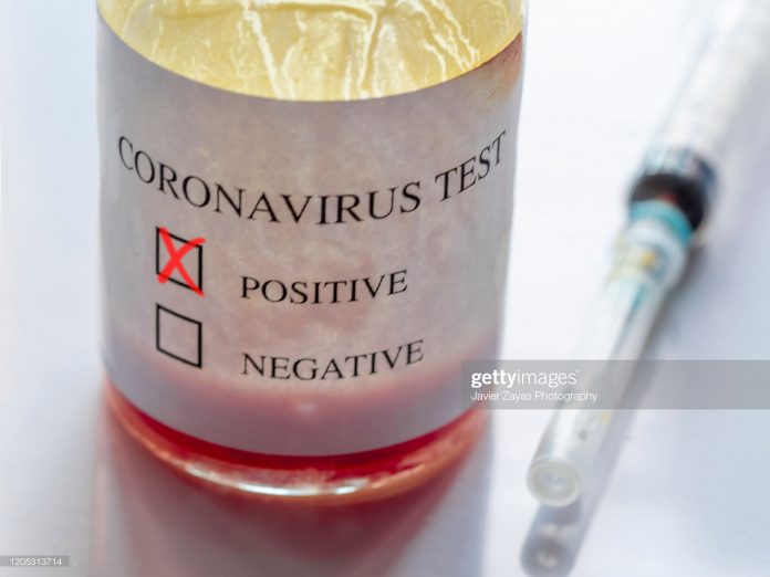 coronavirus-positive-tests coronavirus-positive-tests