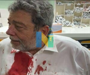 St. Vincent PM Recovering After Head Injury At Protest injured-st-vincent-pm