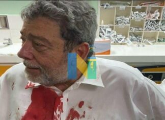 injured-st-vincent-pm