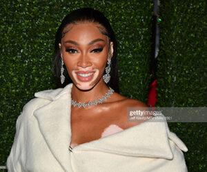 Jamaican Canadian Model Among Attendees At MTV Music Awards Winnie-Harlow-2021-mtv-awards