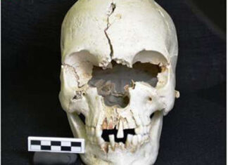 Human Skull Dating Back 200 Years Found On This Caribbean Island skull-found-on-mustique