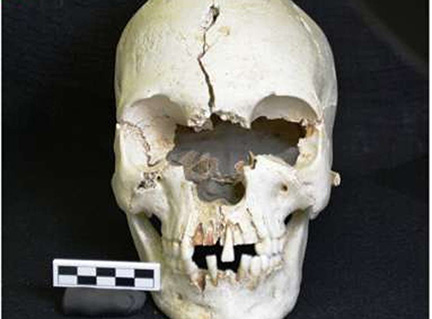 skull-found-on-mustique